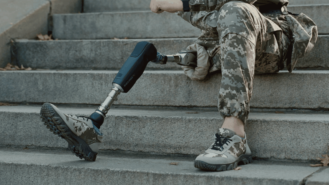 A soldier shared if he would go to war after losing a leg.